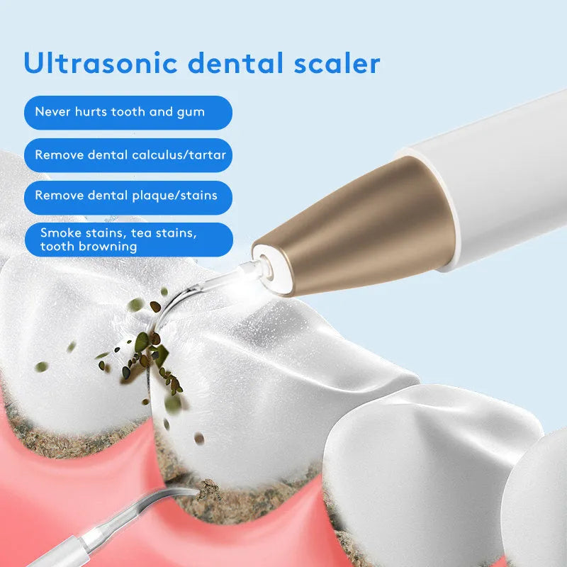 Gold handheld ultrasonic tooth cleaning device for removing tartar and stains