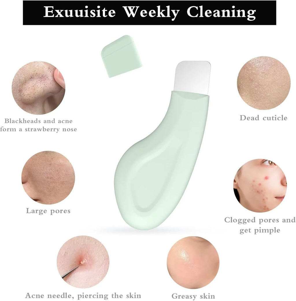 Stainless steel blackhead scraper tool with non-slip handle for facial pore cleansing.