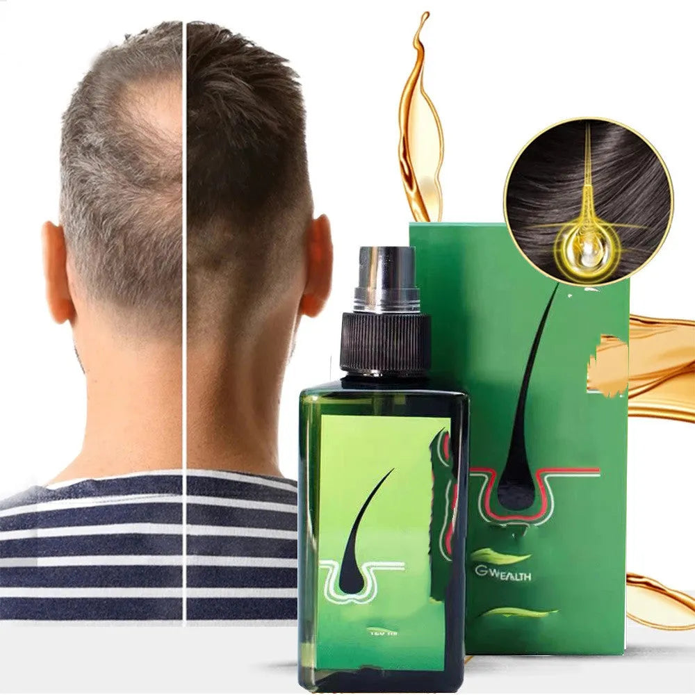 Anti-hair loss shampoo 120ml bottle with dandruff removal, anti-itch, deep repair, nourishing, and scalp oil control, plus free microneedling roller gift
