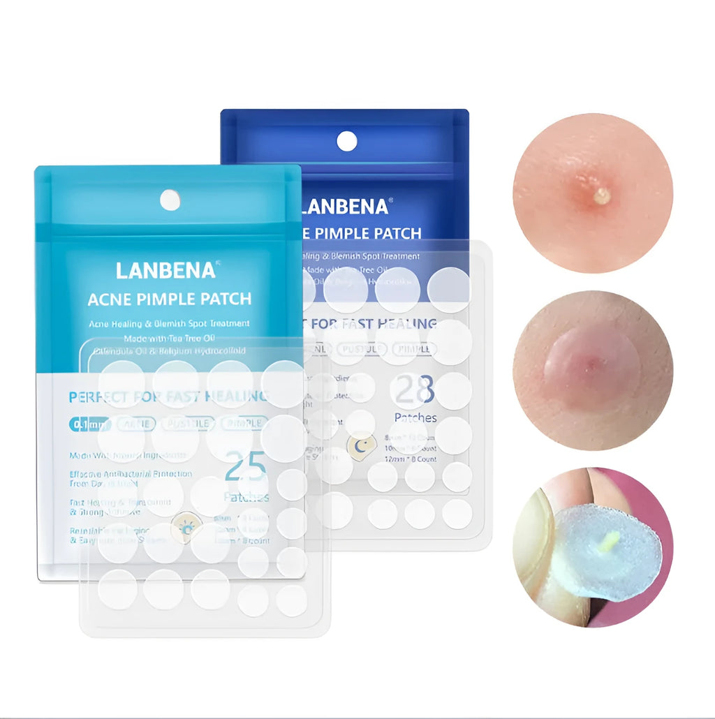 Acne stickers with tea tree oil and Calendula oil for fading blemishes and pimple marks