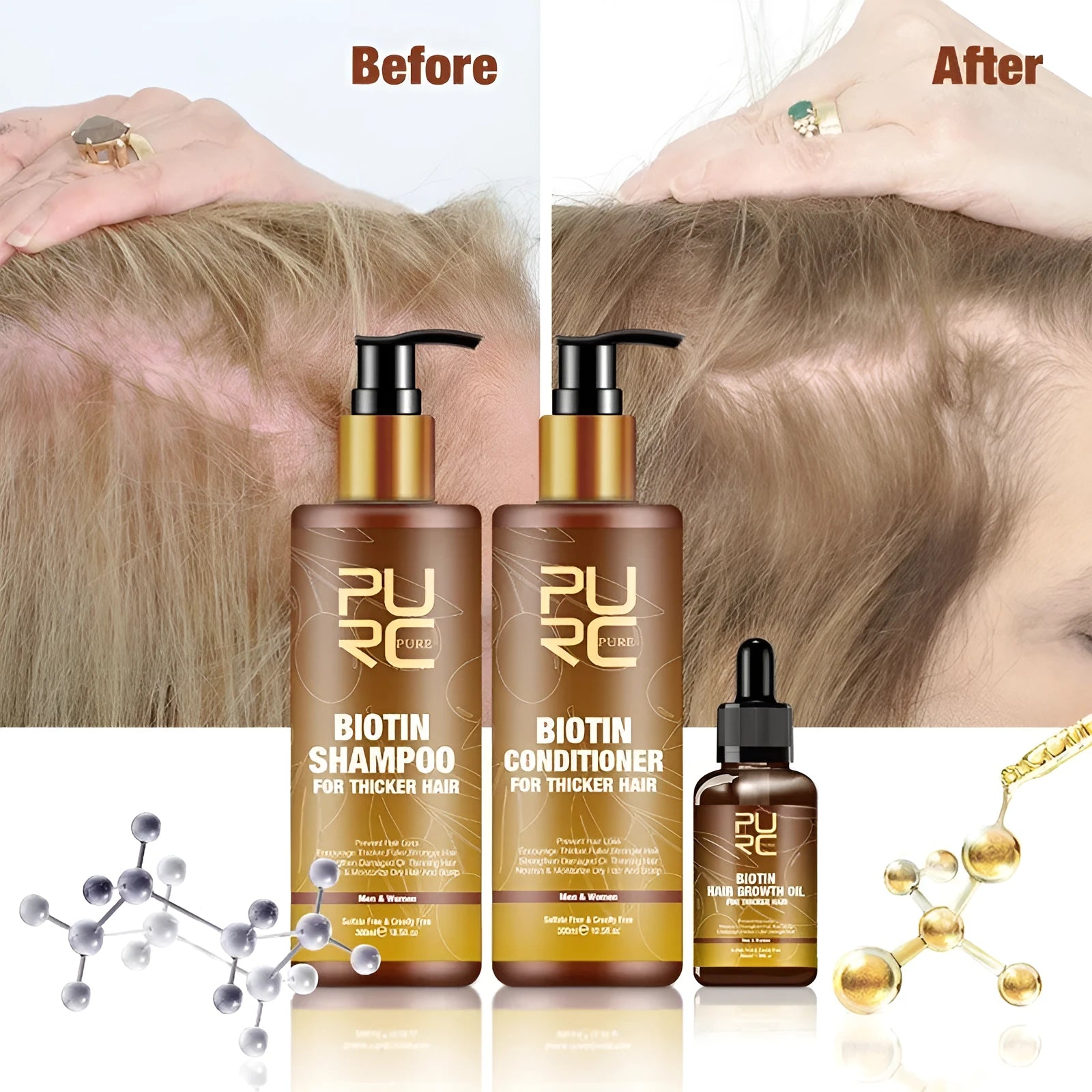 PURC Hair Care Ginger Biotin three-piece set with shampoo, conditioner and biotin essential oil on white background