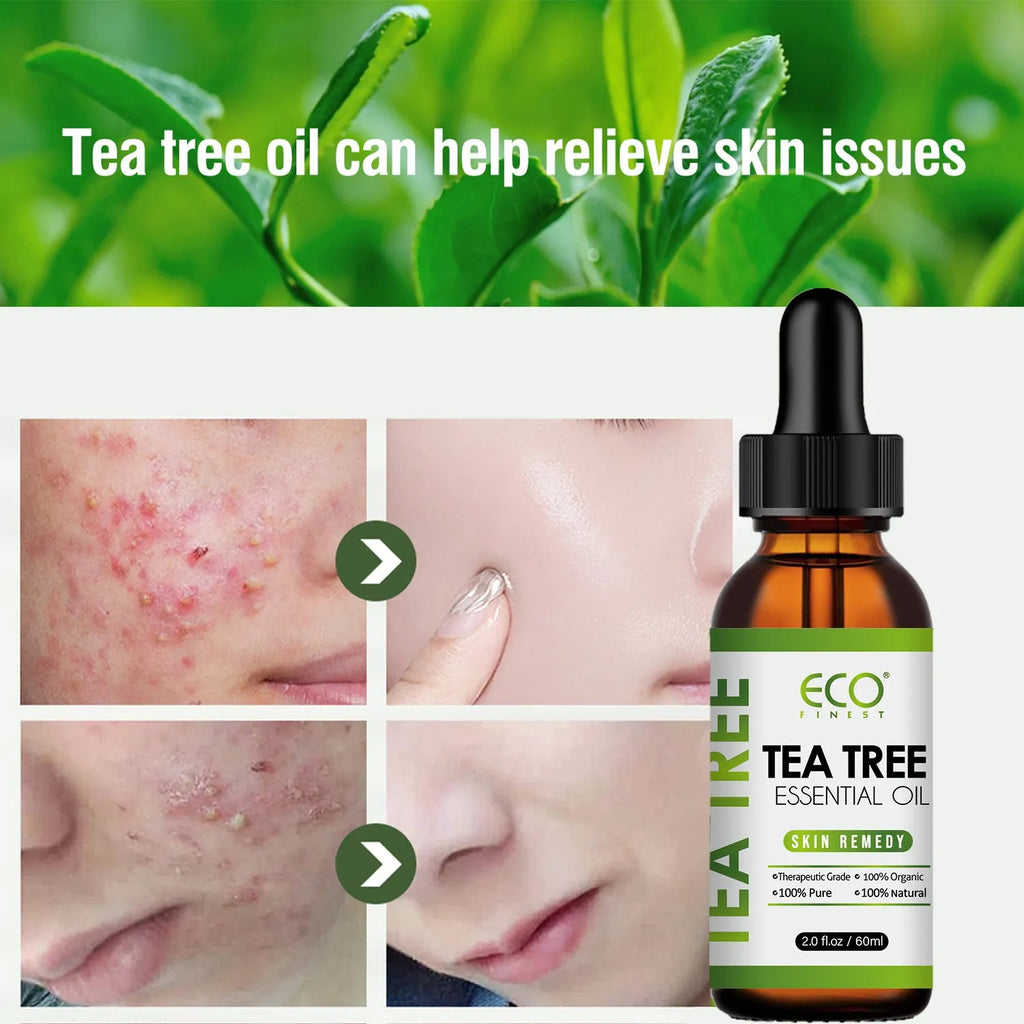 Essential tea tree oil massage oil 60ml bottle for acne skin