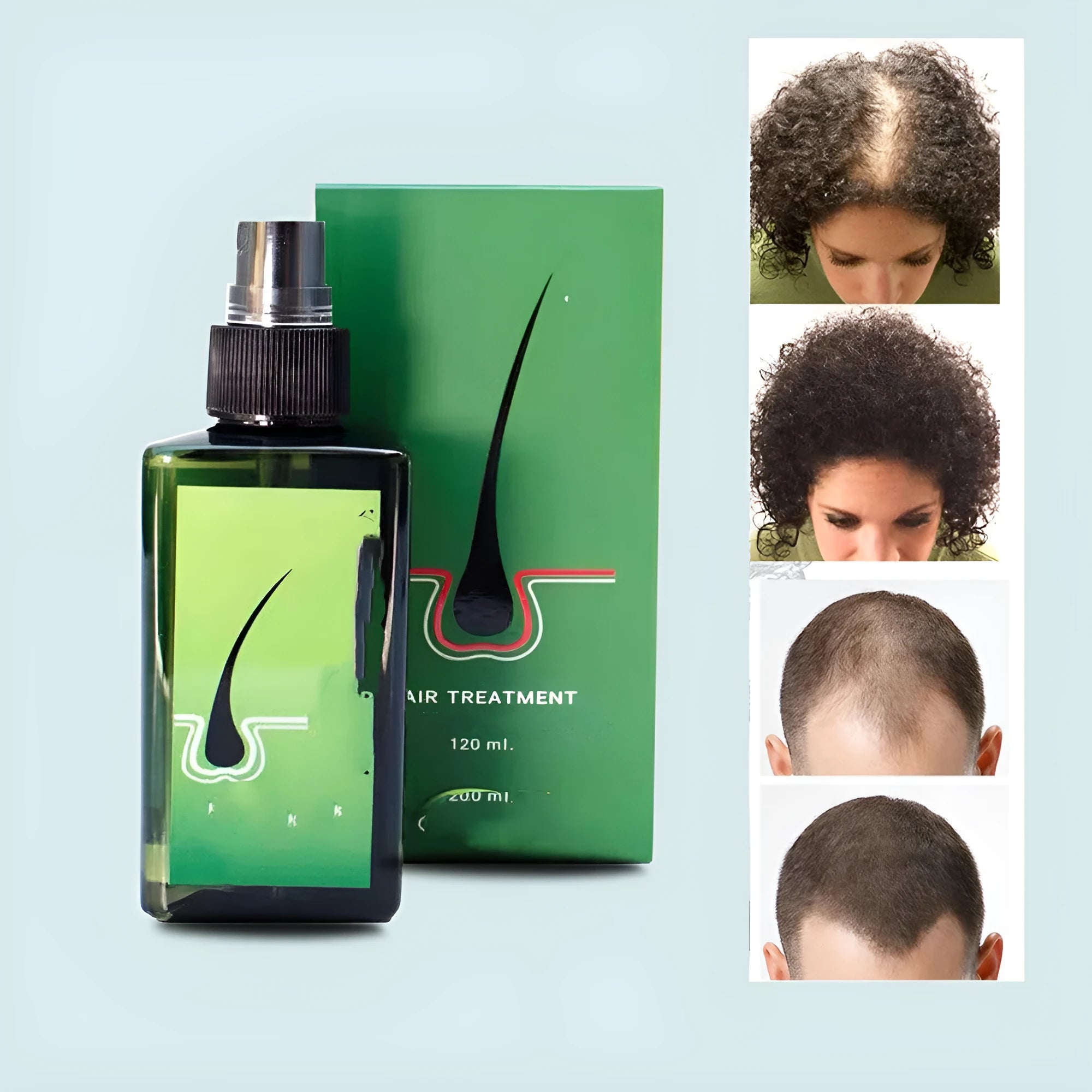 Anti-hair loss shampoo 120ml bottle with dandruff removal, anti-itch, deep repair, nourishing, and scalp oil control, plus free microneedling roller gift