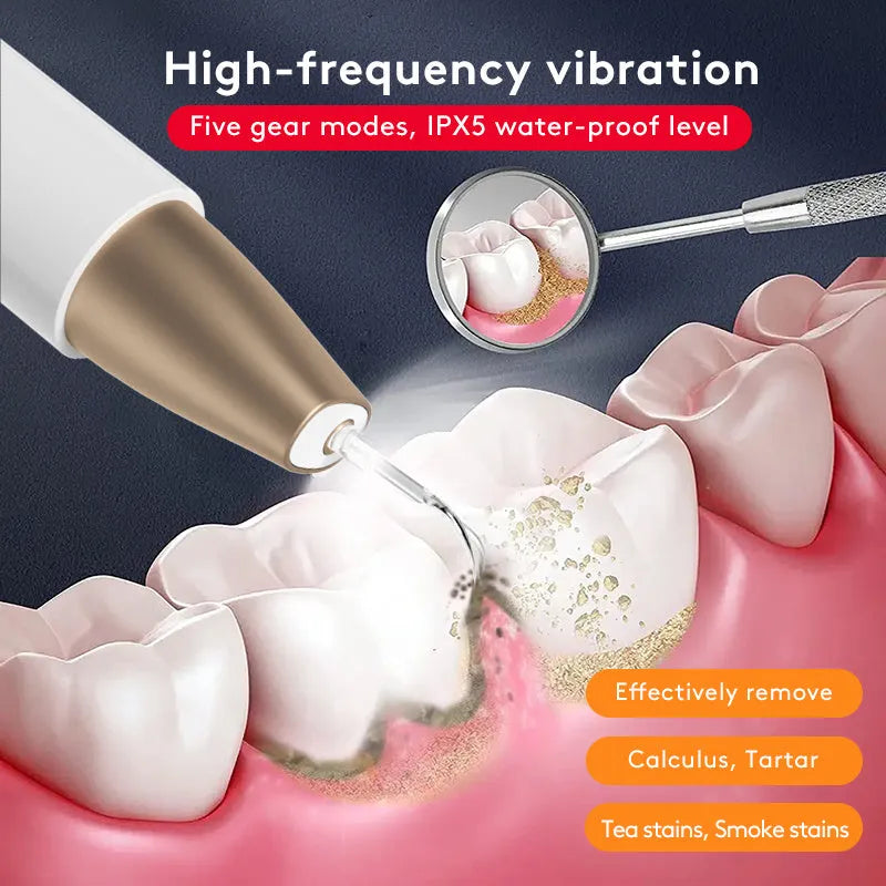 Gold handheld ultrasonic tooth cleaning device for removing tartar and stains