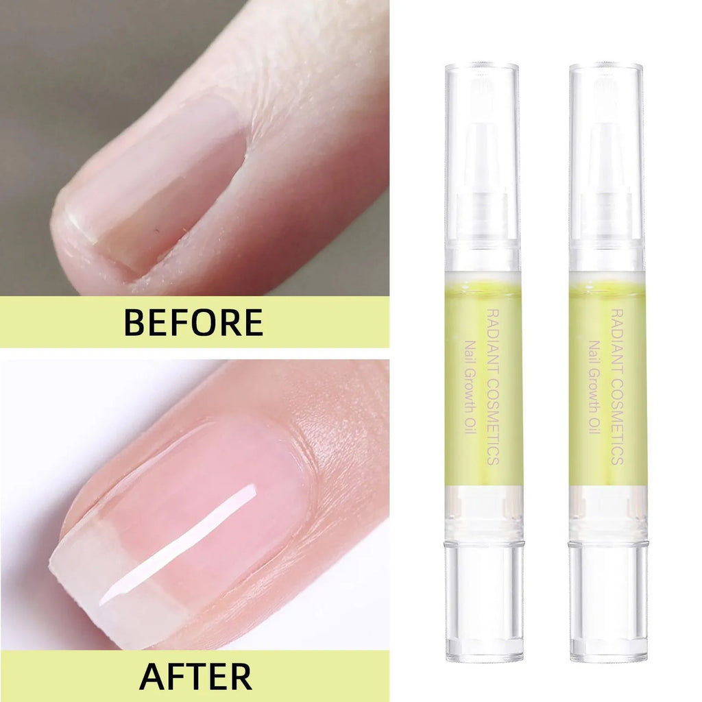 A 3ml bottle of wash-free nail growth treatment oil for moisturising and nail care.
