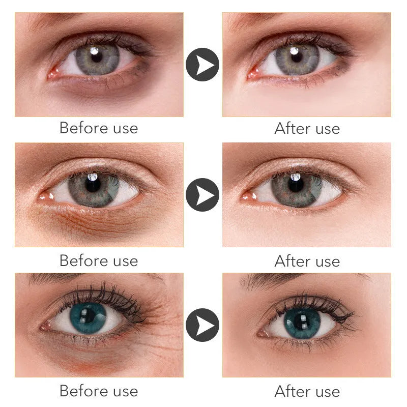 30ml jar of Beauty Eye Cream for women's under-eye skincare.
