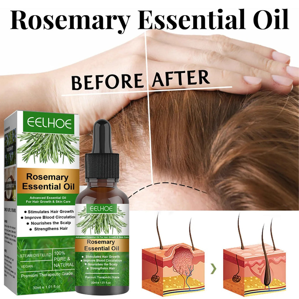 Rosemary Anti-Breakage Nourishing Hair Care Oil 30ml box with rosemary and coconut oil ingredients