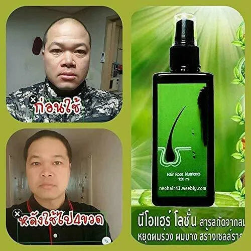 Anti-hair loss shampoo 120ml bottle with dandruff removal, anti-itch, deep repair, nourishing, and scalp oil control, plus free microneedling roller gift