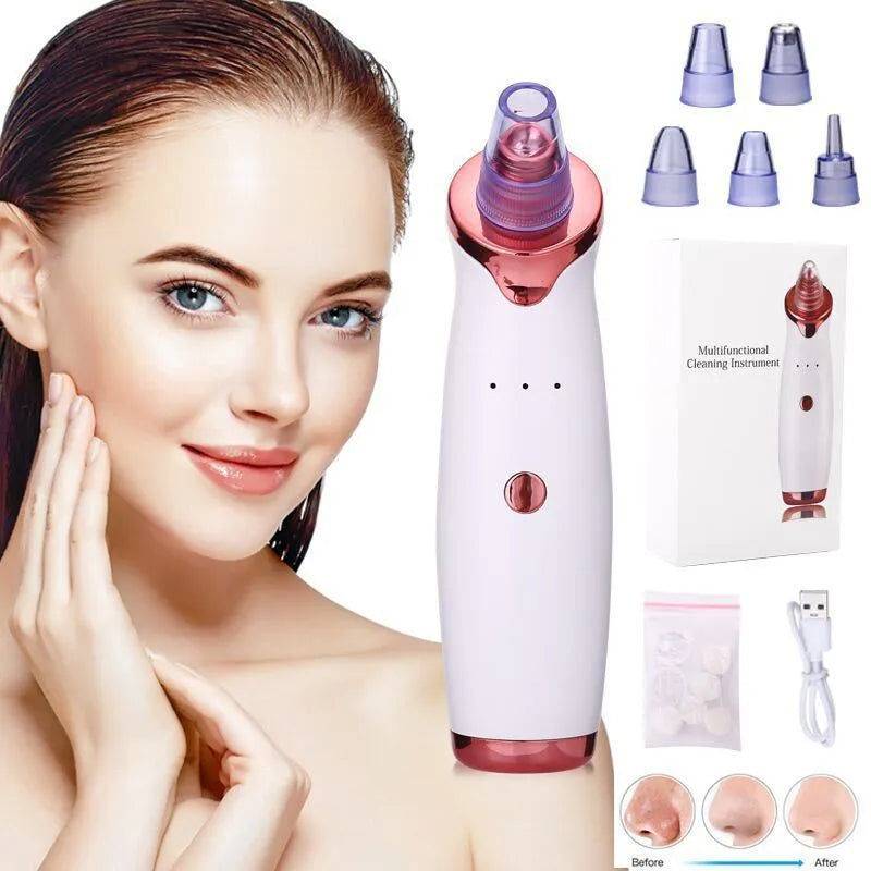 White USB rechargeable ultrasonic pore cleansing beauty device for blackhead removal and acne care