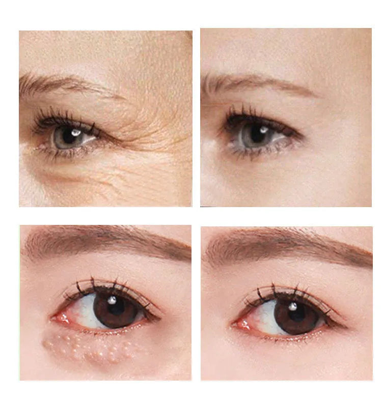 30ml jar of Beauty Eye Cream for women's under-eye skincare.