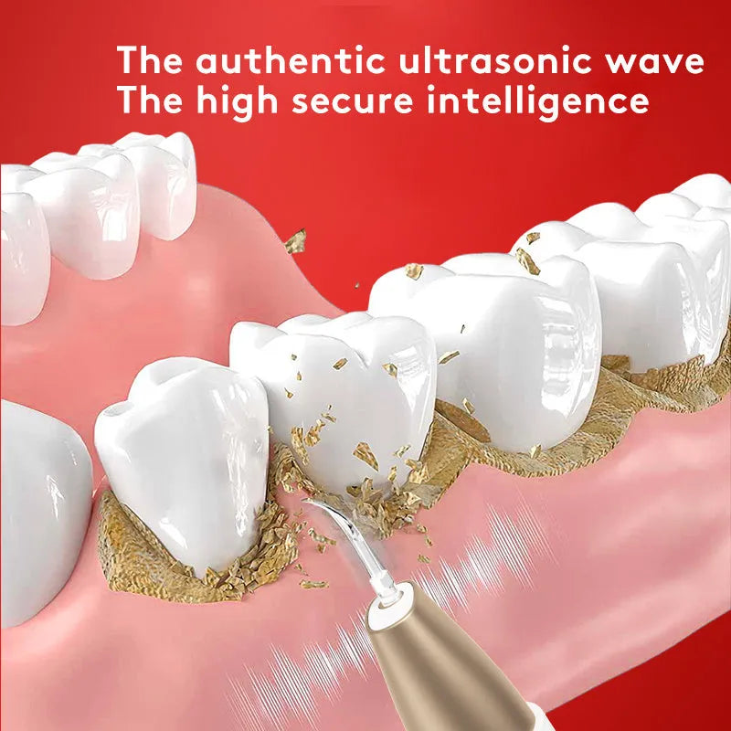 Gold handheld ultrasonic tooth cleaning device for removing tartar and stains